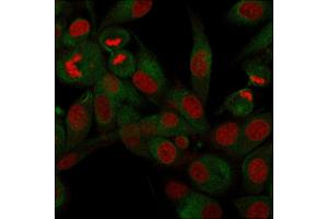 Immunofluorescence (IF) image for anti-CD68 Molecule (CD68) antibody (ABIN6941238)