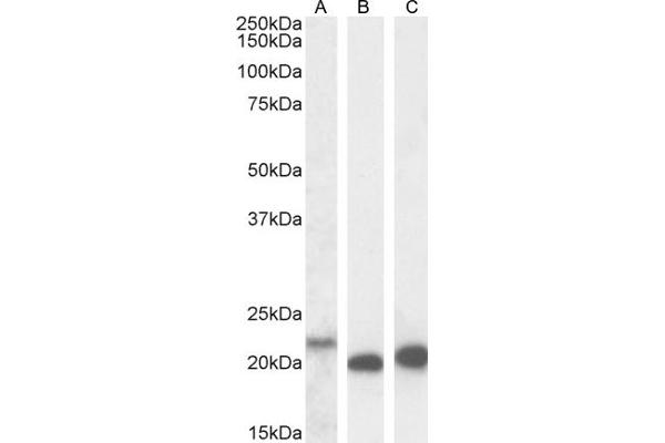 IL-18 antibody  (Internal Region)