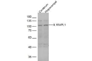 Lane 1: mouse cerebrum Lane 2: mouse hippocampal lysates probed with IL1RAPL1 Polyclonal Antibody, Unconjugated  at 1:1000 dilution and 4˚C overnight incubation. (IL1RAPL1 antibody  (AA 301-400))