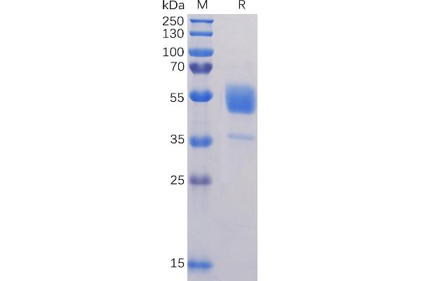 CD37 Protein (AA 112-241) (Fc Tag)