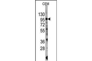 Western blot analysis of anti-PIK3CG Antibody (S1100) in CEM cell line lysates (35ug/lane). (PIK3 gamma antibody  (AA 1079-1102))