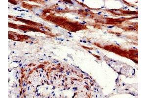 Immunohistochemistry of paraffin-embedded human heart tissue using ABIN7146837 at dilution of 1:100 (CPT1B antibody  (AA 165-318))