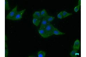 Immunofluorescence staining of Hela cells with ABIN7156695 at 1:200, counter-stained with DAPI. (EIF2AK2 antibody  (AA 90-358))