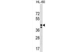 Western Blotting (WB) image for anti-Mitochondrial Ribosomal Protein S31 (MRPS31) antibody (ABIN3000449) (MRPS31 antibody)