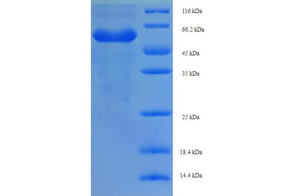 RYBP Protein (AA 1-389, partial) (His-SUMO Tag)