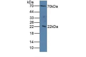 Western Blotting (WB) image for Interleukin 1 Receptor Accessory Protein (IL1RAP) ELISA Kit (ABIN6730975)