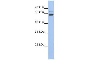 GEFT antibody used at 1 ug/ml to detect target protein. (ARHGEF25/GEFT antibody  (C-Term))