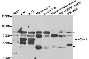 Western blot analysis of extracts of various cell lines, using KCNN3 antibody (ABIN6293039) at 1:1000 dilution. (KCNN3 antibody)