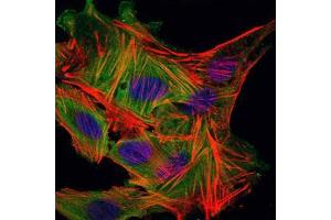 Immunofluorescence analysis of MSCS cells using MBP mouse mAb (green). (MBP antibody)