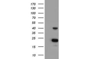 Western Blotting (WB) image for anti-Enoyl-CoA Delta Isomerase 2 (PECI) antibody (ABIN1497946) (PECI/ECI2 antibody)