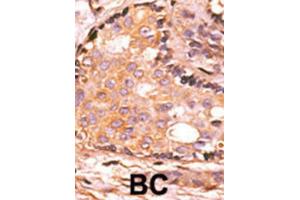 Immunohistochemistry (IHC) image for anti-Dual Specificity Phosphatase 4 (DUSP4) antibody (ABIN3003764) (DUSP4 antibody)