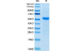 SDS-PAGE (SDS) image for delta Like Protein 3 (DLL3) (AA 27-490) protein (His tag) (ABIN7274489)