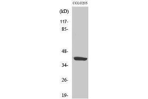 Western Blotting (WB) image for anti-Cysteinyl Leukotriene Receptor 1 (CYSLTR1) (Internal Region) antibody (ABIN3174677) (CysLTR1 antibody  (Internal Region))