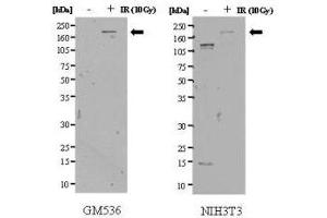 Anti-SMC1 pS957 Antibody - Western Blot. (SMC1A antibody  (AA 951-962))