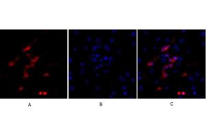 Immunofluorescence analysis of human liver tissue. (p53 antibody)