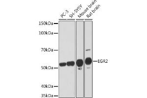 Western blot analysis of extracts of various cell lines, using EGR2 Rabbit mAb (ABIN1682321, ABIN7101509, ABIN7101510 and ABIN7101511) at 1:1000 dilution. (EGR2 antibody)