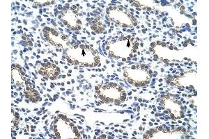 Cytokeratin 18 antibody was used for immunohistochemistry at a concentration of 4-8 ug/ml to stain Alveolar cells (arrows) in Human Lung. (Cytokeratin 18 antibody  (C-Term))