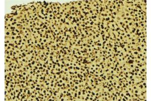 ABIN6277440 at 1/100 staining Mouse liver tissue by IHC-P. (SUMO3 antibody  (C-Term))