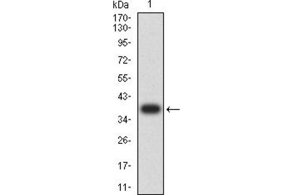 ALDH1A1 anticorps  (AA 1-110)