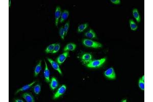 Immunofluorescent analysis of HepG2 cells using ABIN7171874 at dilution of 1:100 and Alexa Fluor 488-congugated AffiniPure Goat Anti-Rabbit IgG(H+L) (TSPAN33 antibody  (AA 118-235))