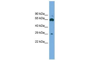 GLIPR1L1 antibody used at 1 ug/ml to detect target protein. (GLIPR1L1 antibody  (Middle Region))