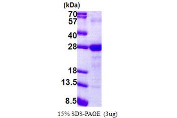 LY6G6F Protein (AA 17-235) (His tag)