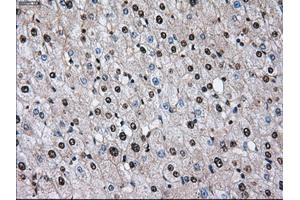 Immunohistochemical staining of paraffin-embedded liver tissue using anti-ID3mouse monoclonal antibody. (ID3 antibody)