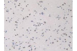 IHC-P analysis of Human Brain Tissue, with DAB staining. (HNRNPA1 antibody  (AA 2-372))