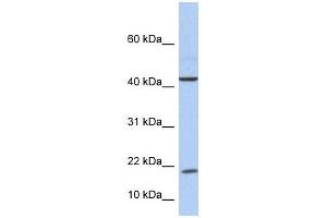 IL9 antibody used at 1 ug/ml to detect target protein. (IL-9 antibody  (Middle Region))