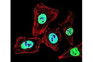 Fluorescent confocal image of HeLa cell stained with HDAC2 antibody at 1:25. (HDAC2 antibody  (AA 410-439))