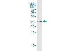 ADIPOQ polyclonal antibody (A01). (ADIPOQ antibody  (AA 111-210))