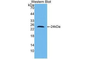 Western blot analysis of recombinant Human IL10. (IL-10 antibody  (AA 1-178))