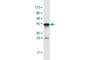 Western Blot detection against Immunogen (45. (VPS25 antibody  (AA 1-176))