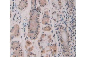 IHC-P analysis of Human Tissue, with DAB staining. (HDLBP antibody  (AA 158-371))