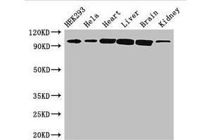 Western Blot Positive WB detected in: HEK293 whole cell lysate, Hela whole cell lysate, Mouse heart tissue, Mouse liver tissue, Mouse brain tissue, Mouse kidney tissue All lanes: CDH2 antibody at 3 μg/mL Secondary Goat polyclonal to rabbit IgG at 1/50000 dilution Predicted band size: 100, 98 kDa Observed band size: 100 kDa (N-Cadherin antibody  (AA 746-906))