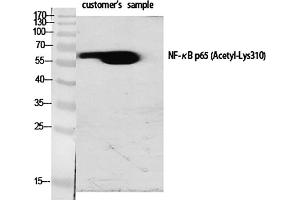 Western Blot analysis of various cells using Acetyl-NFκB-p65 (K310) Polyclonal Antibody diluted at 1:1000. (NF-kB p65 antibody  (acLys310))