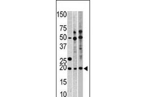 Western blot analysis of anti-RPL23A Pab in, from left to right, CEM, Hela, and HepG2 cell line lysates (35ug/lane) (RPL23A antibody  (C-Term))