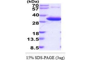 SDS-PAGE (SDS) image for 3-Hydroxymethyl-3-Methylglutaryl-CoA Lyase (HMGCL) (AA 28-325) protein (His tag) (ABIN5854983) (HMGCL Protein (AA 28-325) (His tag))