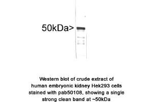 Image no. 1 for anti-Vimentin (VIM) antibody (ABIN363417) (Vimentin antibody)