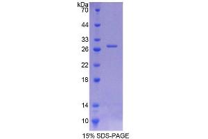 SDS-PAGE analysis of Rat ITSN1 Protein. (ITSN1 Protein)