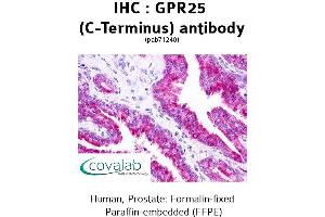Image no. 2 for anti-G Protein-Coupled Receptor 25 (GPR25) (C-Term) antibody (ABIN1735034) (GPR25 antibody  (C-Term))