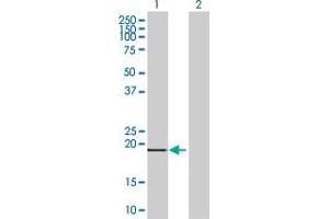 Western Blotting (WB) image for FTL 293T Cell Transient Overexpression Lysate(Denatured) (ABIN1331875)