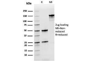 SDS-PAGE (SDS) image for anti-Nucleophosmin (Nucleolar phosphoprotein B23, Numatrin) (NPM1) (AA 185-287) antibody (ABIN6940222)