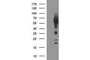 Image no. 1 for anti-Tyrosine Hydroxylase (TH) antibody (ABIN1501367) (Tyrosine Hydroxylase antibody)