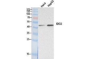 Western Blotting (WB) image for anti-Indoleamine 2,3-Dioxygenase 2 (IDO2) (Internal Region) antibody (ABIN6280734) (IDO2 antibody  (Internal Region))