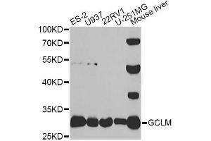 Western blot analysis of extracts of various cell lines, using GCLM antibody. (GCLM antibody)