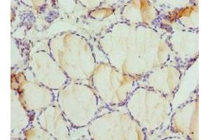 Immunohistochemistry of paraffin-embedded human thyroid tissue using ABIN7149983 at dilution of 1:100 (DPP3 antibody  (AA 1-280))