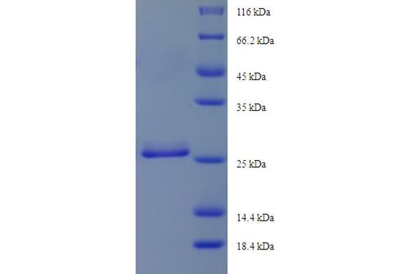 DYNLRB1 Protein (AA 3-96, partial) (His-SUMO Tag)