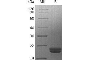 Greater than 95 % as determined by reducing SDS-PAGE. (IL16 Protein)