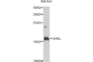 Western blot analysis of extracts of rat liver, using GHRL antibody (ABIN6292644) at 1:1000 dilution. (Ghrelin antibody)